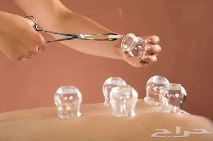 حجامه منزليه علاجية ووقائيه 2