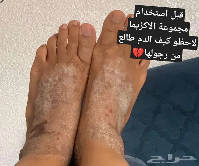 بوكس العناية الصحية من شركة فوريفر البريطانية مع هدية 76