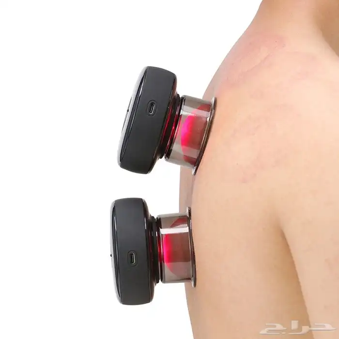 جهاز الحجامة الكهربائية بسعر ممتاز 2