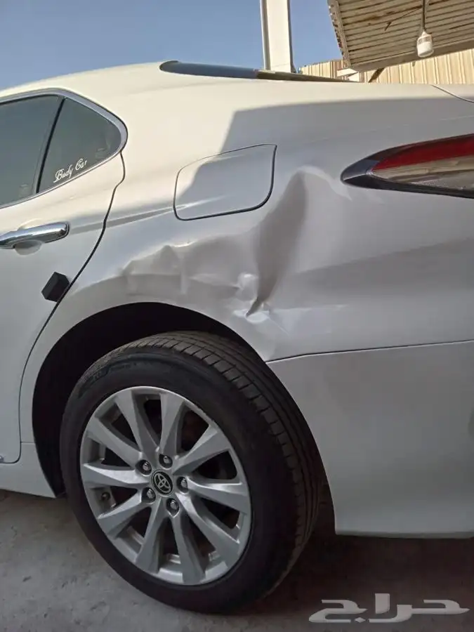 شفط وتعديل الصدمات بدون رش بويه 13