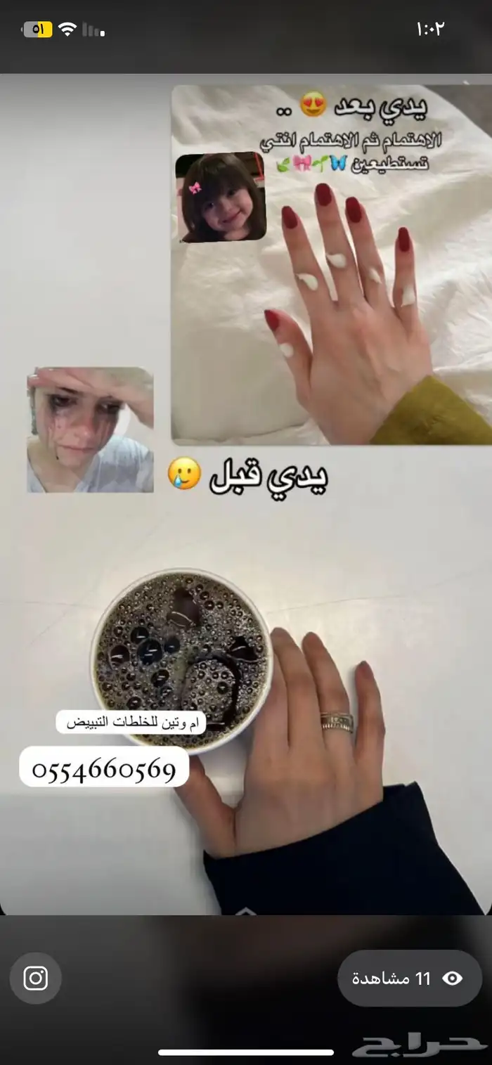 كريمات تبييض 8