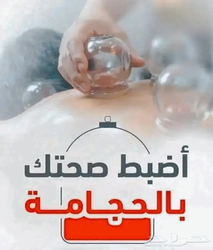 الحجامه والخلعه 2