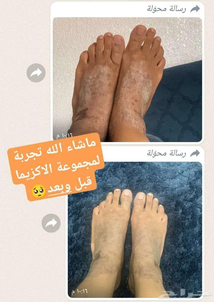 بوكس العناية الصحية من شركة فوريفر البريطانية مع هدية بسيطة 1