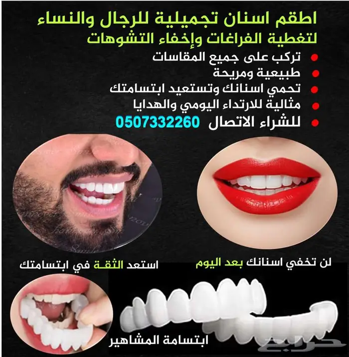 للبيع تلبيسات اسنان تجميلية 0