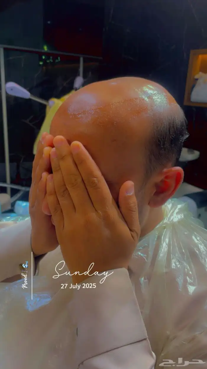 تركيب شبكيات شعر طبيعي بجوده عاليه 5