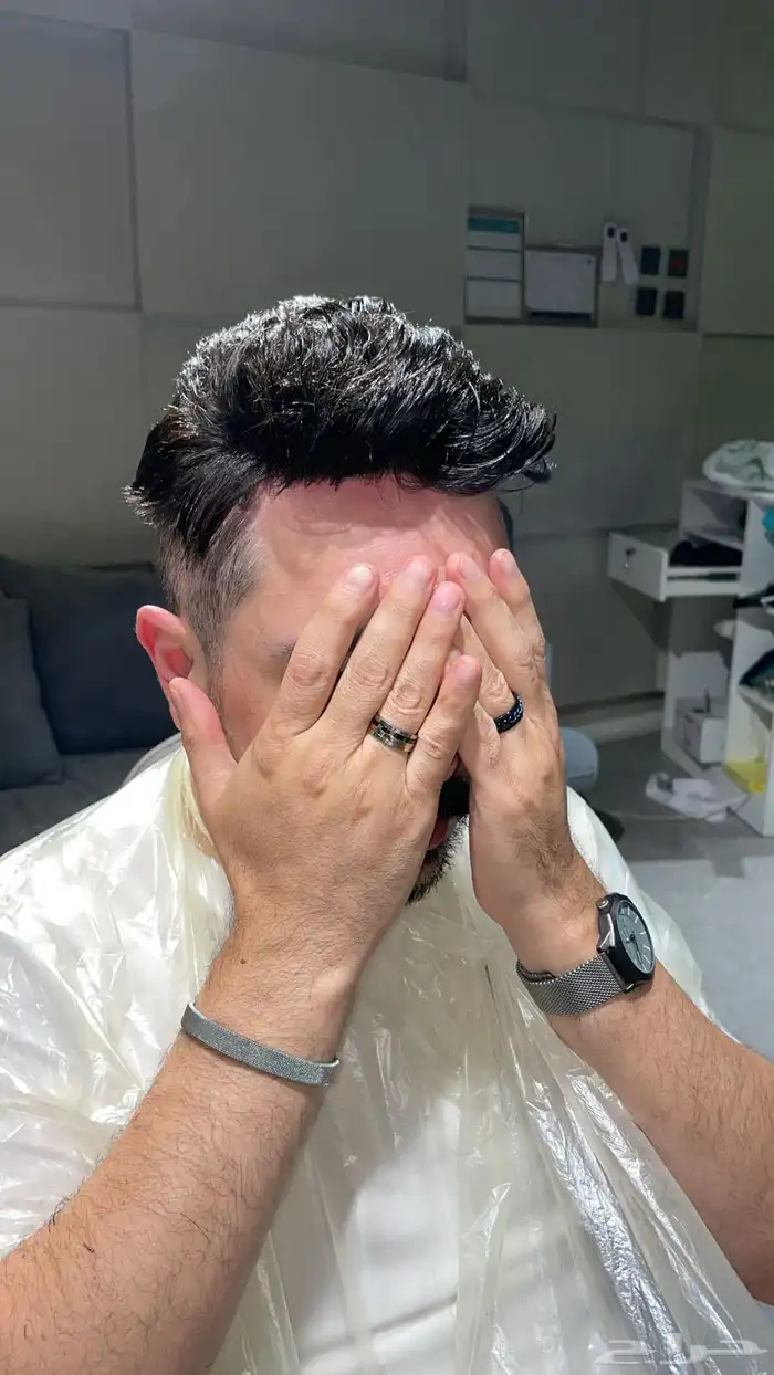 تركيب شبكيات شعر طبيعي بجوده عاليه 1