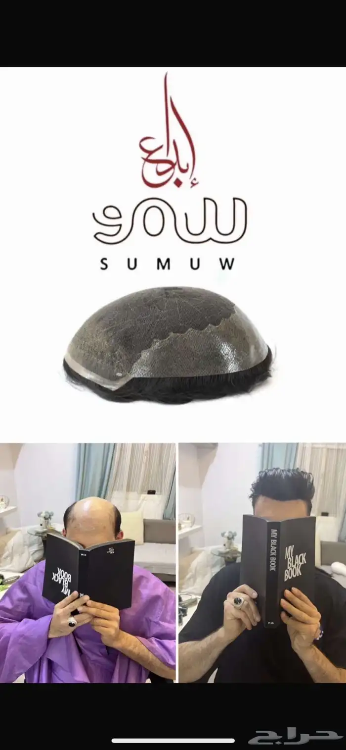 تركيب شبكيات شعر طبيعي بجوده عاليه 19