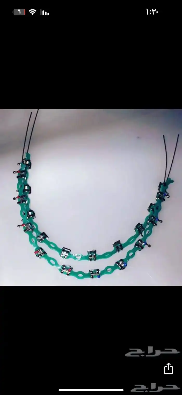 تقويم اسنان زينه 1