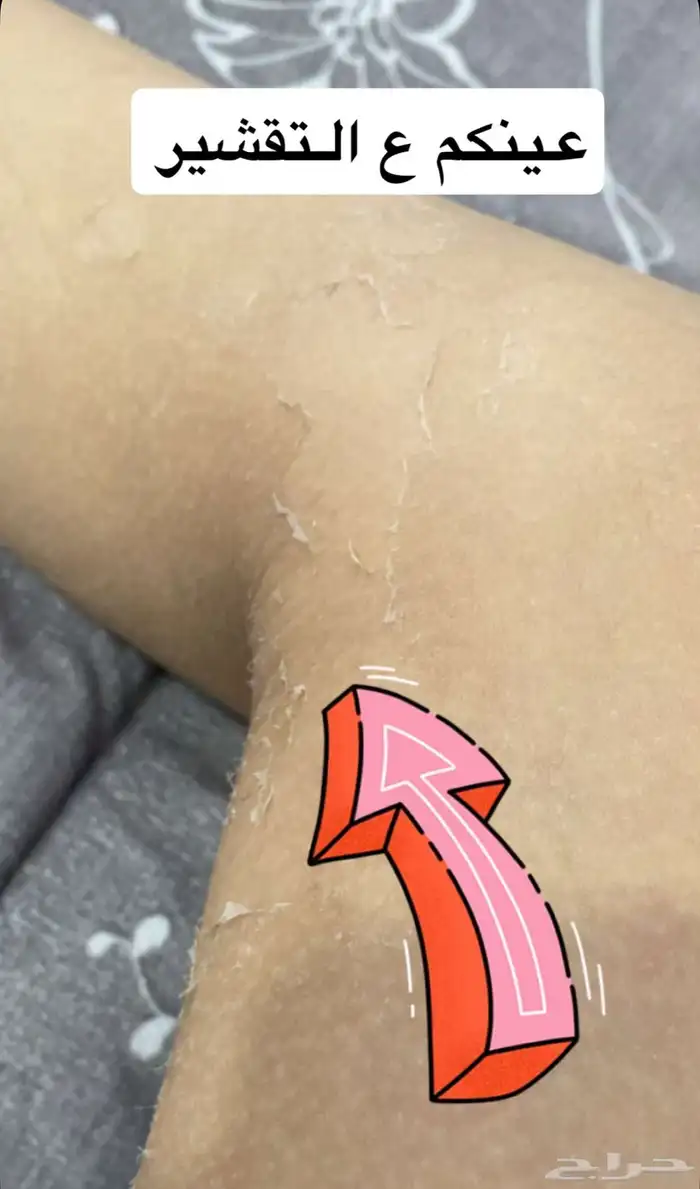 كريم بديل ابرالتبيض 0