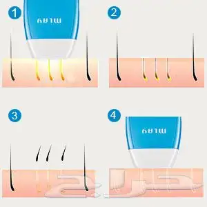 جهاز ليرز منزلي ملاي 2