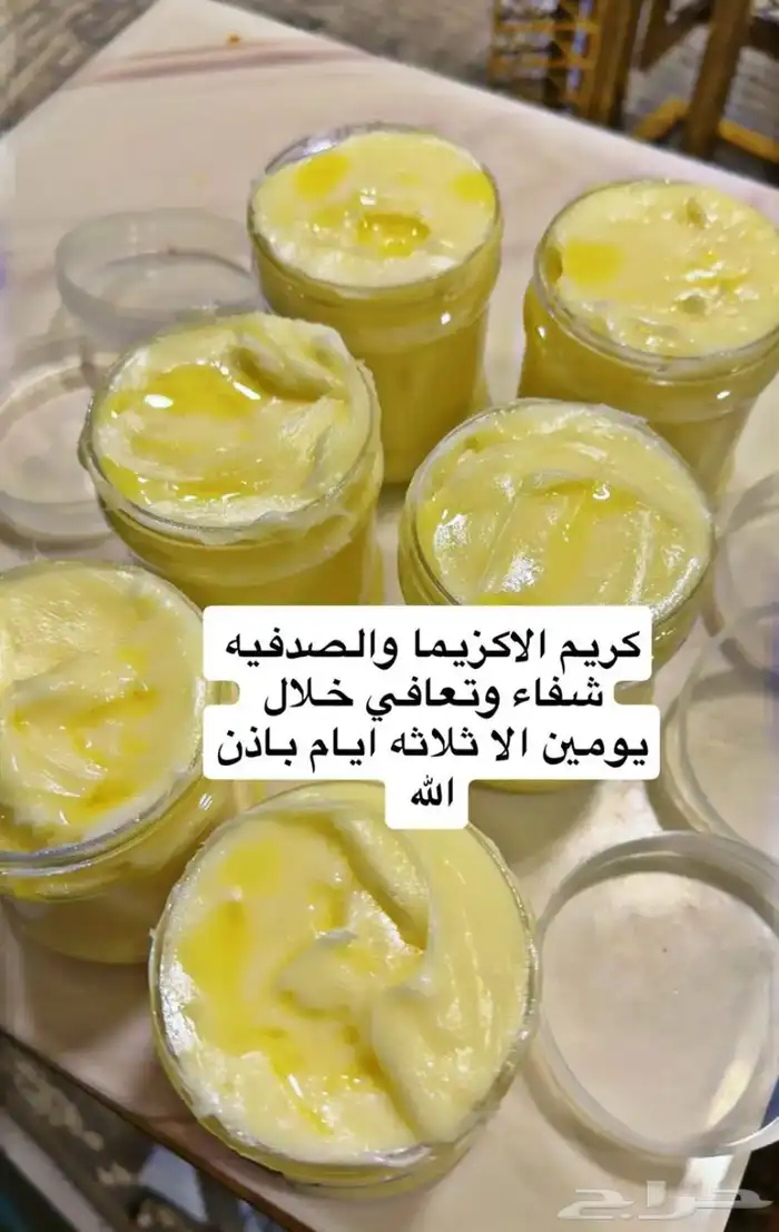 بالذمه والضمير يوجد زيت لتطويل الشعر 0