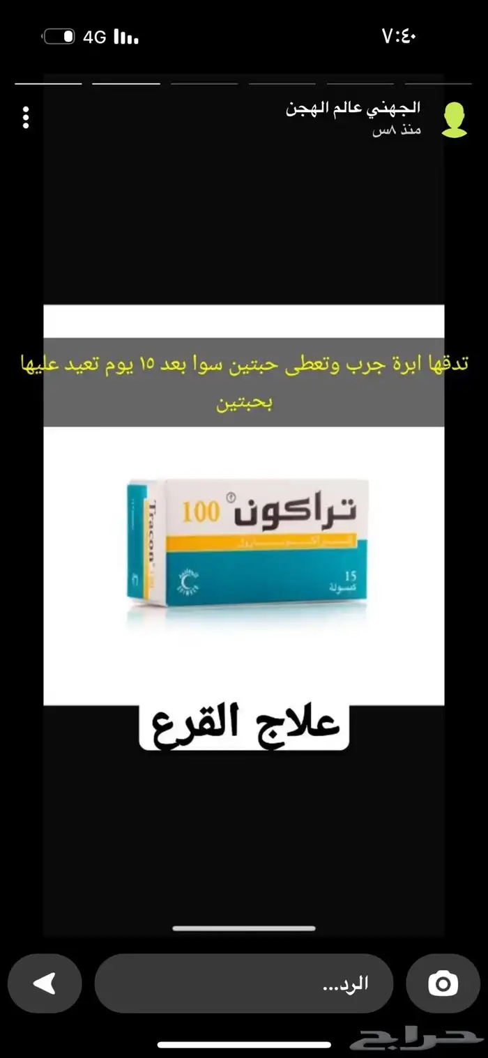 باب صندوق قلاب 7