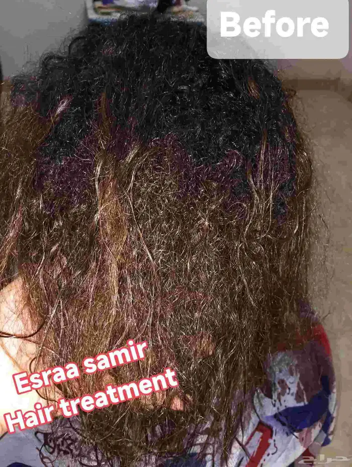 جلسات الهيرو بيبى بالاعشاب حقيقى نقله مختلفه للجلسات العلاج 0