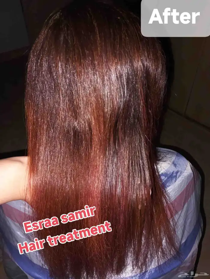 جلسات الهيرو بيبى بالاعشاب حقيقى نقله مختلفه للجلسات العلاج 1