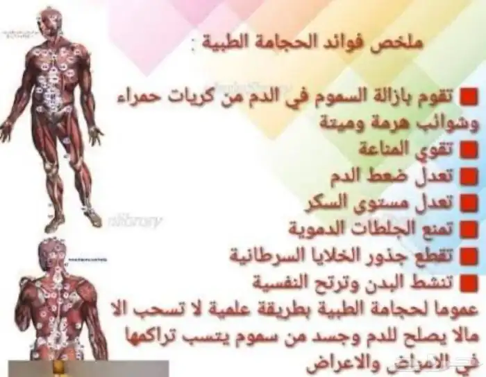 جلسات حجامه علاجيه واستشفائيه 1