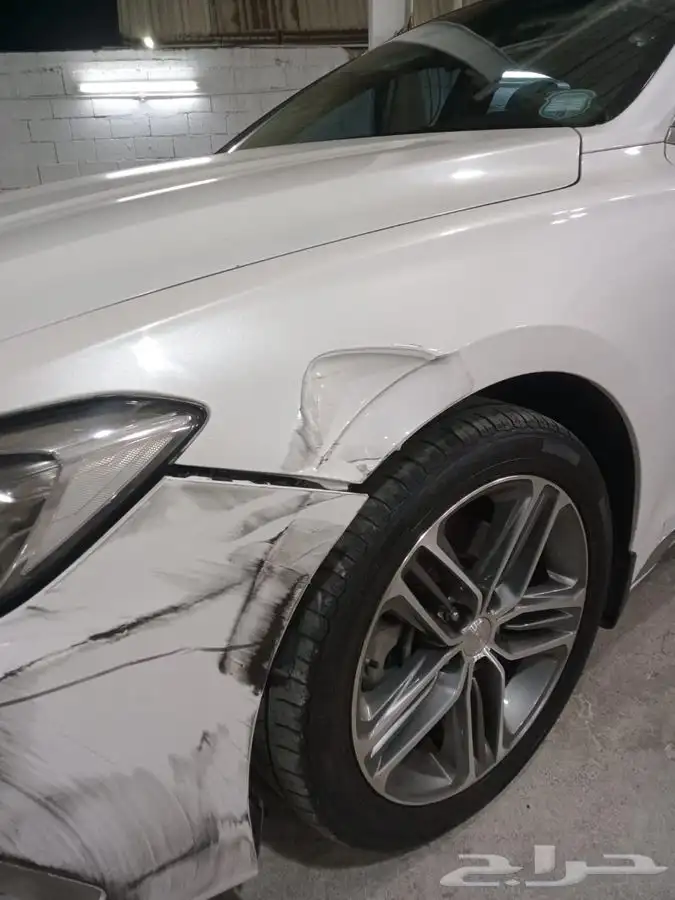 شفط وتعديل الصدمات بدون بويه 12