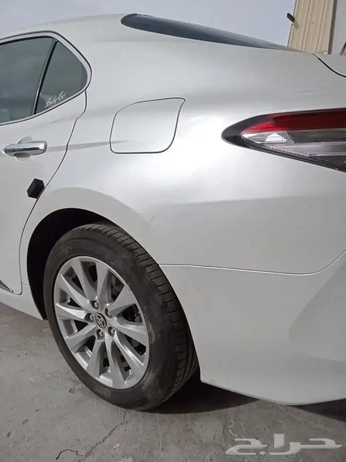 شفط وتعديل الصدمات بدون بويه 15