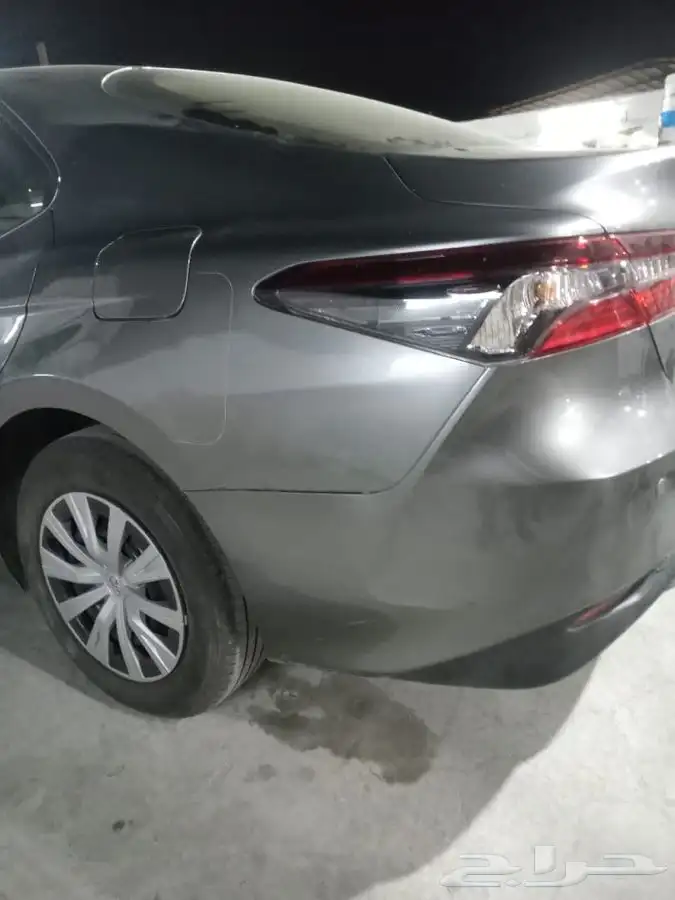 شفط وتعديل الصدمات بدون بويه 3