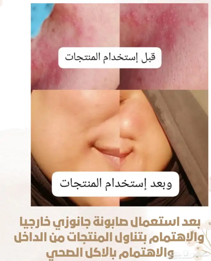 العناية المكثفه للبشرة 0