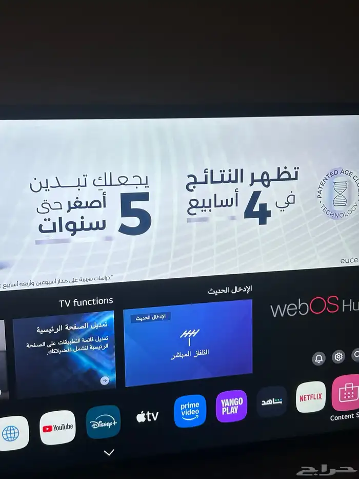 بلازمة 2
