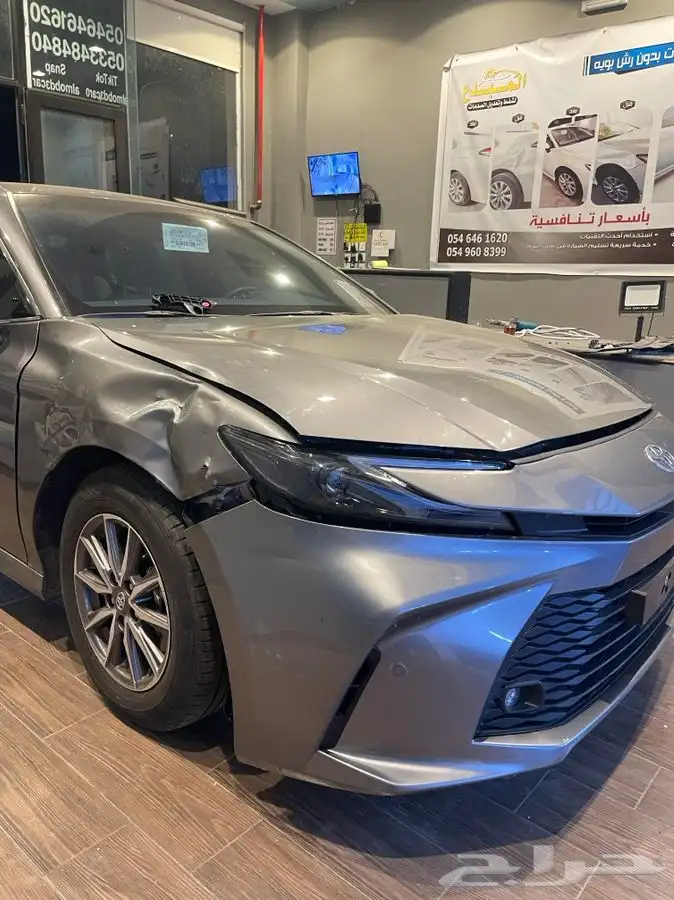 شفط وتعديل الصدمات بدون رش بويه 0