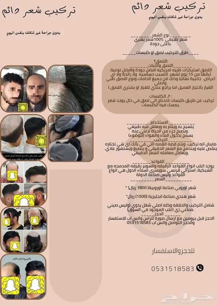 باروكة رجاليه دائمة 0