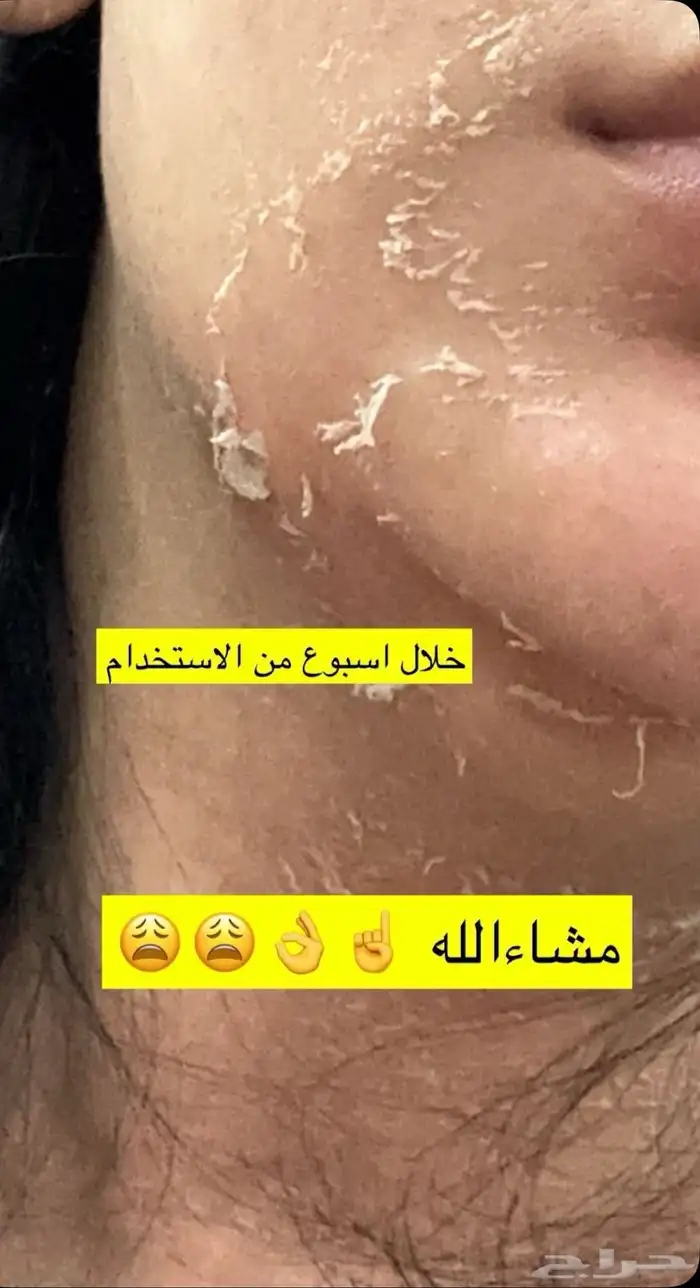 كريم تبيض كوين بديل ابرالتبيض 2