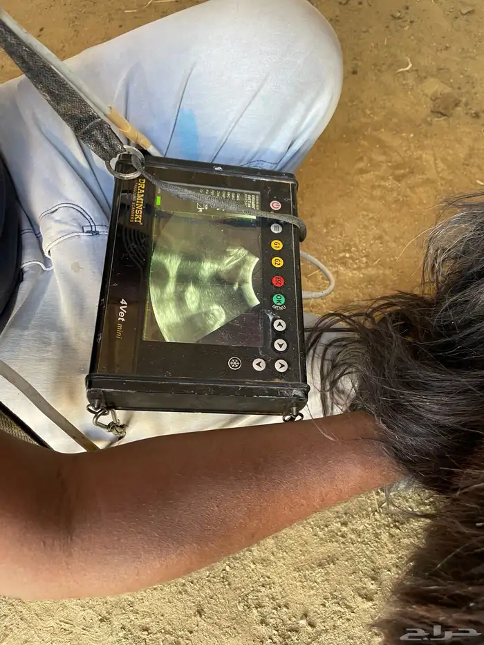 معزاء عوارض 15