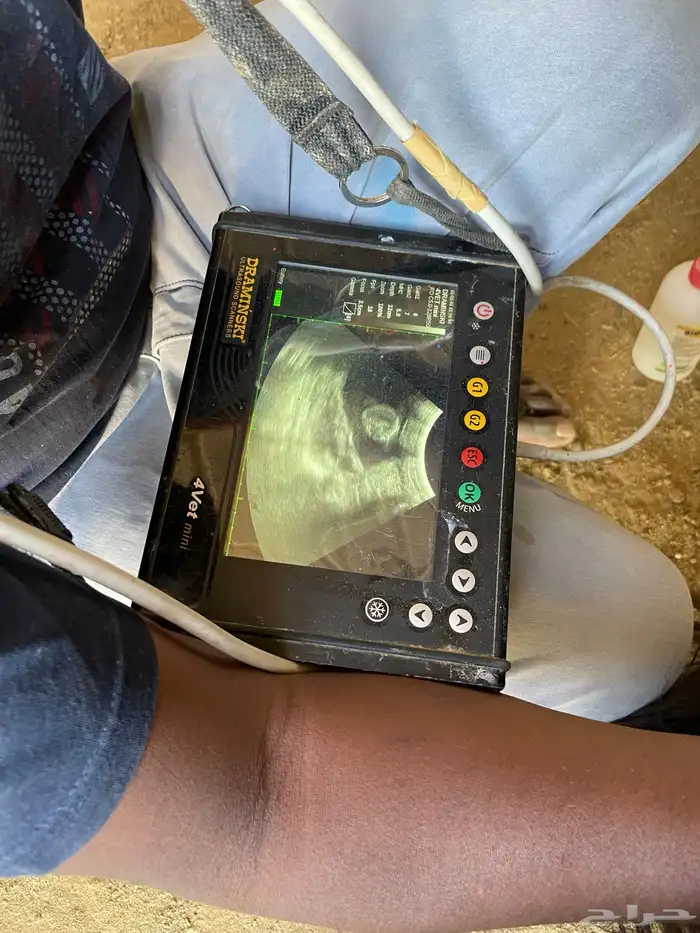 معزاء عوارض 18