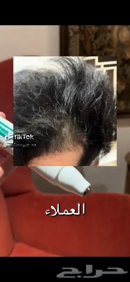 سيروم فايف لاب viveLabلمعالجة الشعر من التساقط وانبات الشعر 3