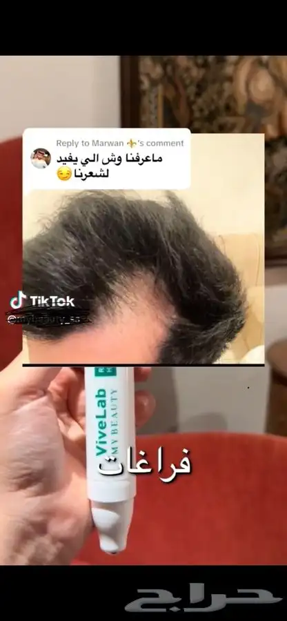 سيروم فايف لاب viveLabلمعالجة الشعر من التساقط وانبات الشعر 2