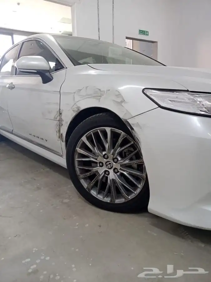 شفط وتعديل الصدمات بدون رش بويه 14