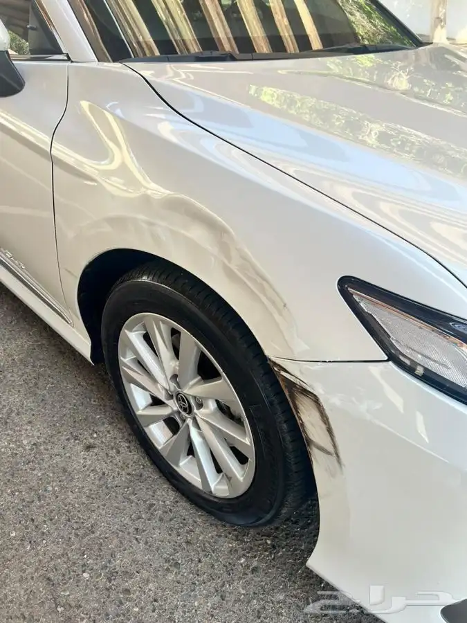 شفط وتعديل الصدمات بدون رش بويه 4