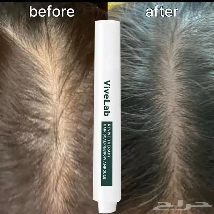 سيروم فايف لاب viveLabلمعالجة الشعر من التساقط وانبات الشعر 0