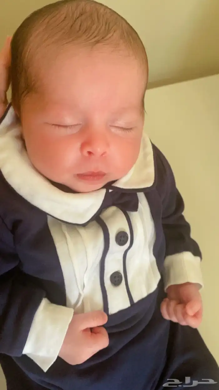 جذامه  وستاند 3