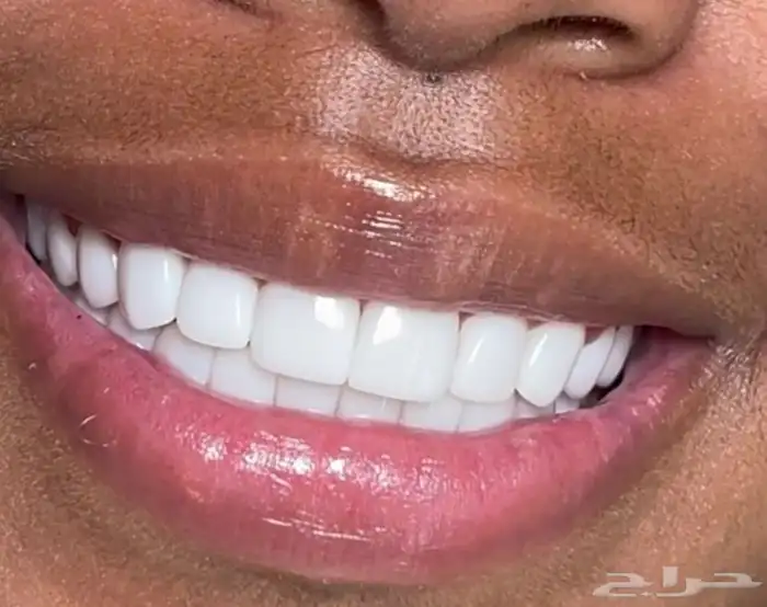 ابتسامة متحركة 2