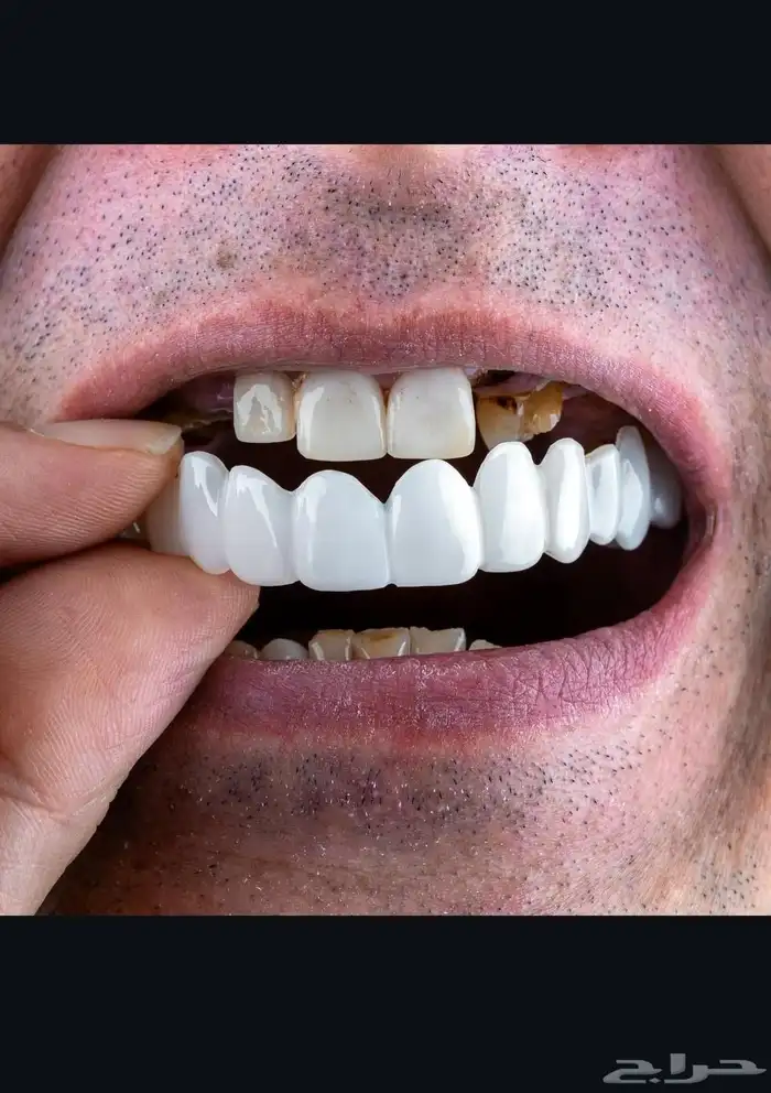 ابتسامة متحركة 1