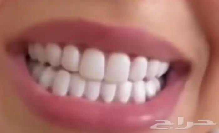 ابتسامة متحركة 0