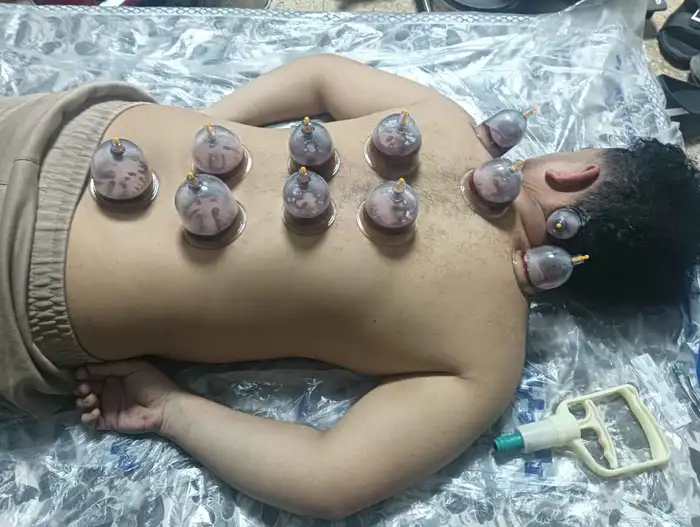 الحجامة النبوية بالمدينة المنورة 2