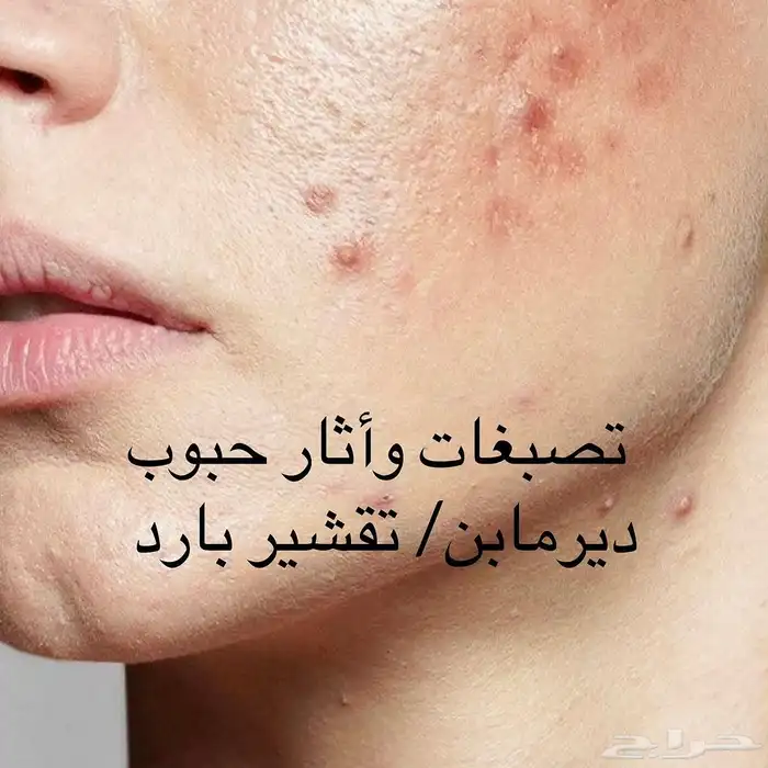 تنظيف وتفتيح ونضارة البشرة 8