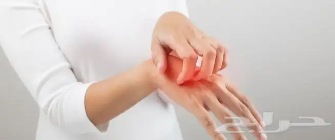 مين موجود  بالسعودية ويعاني من  الاكزيما 1