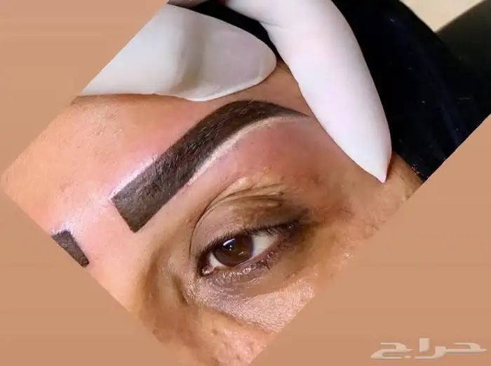 نظيف بشرة ميكروبليدنج. توريدشفايف 7