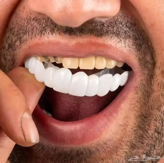 ابتسامة هوليود 5