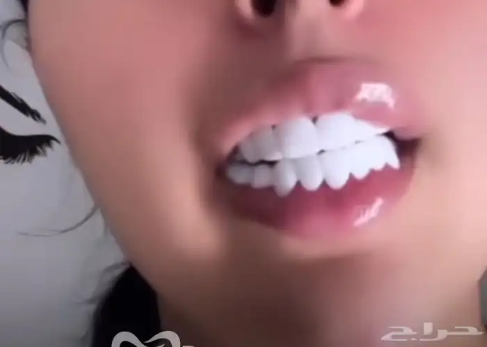 ابتسامة هوليود 0
