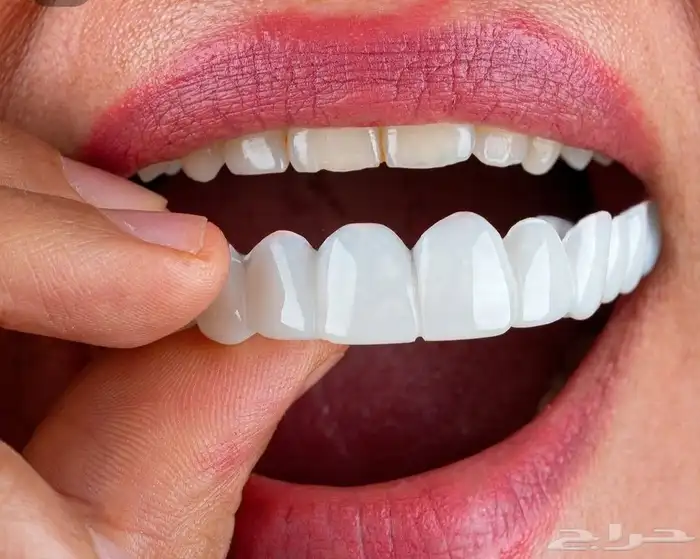 ابتسامة متحركة تجميلية 1