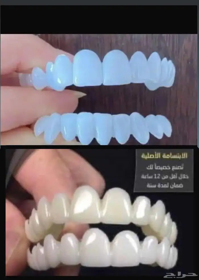 ابتسامة متحركة تجميلية 3
