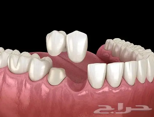 نشر بحث في جميع التخصصات الطبيه في مجلة علمية محكمه 0