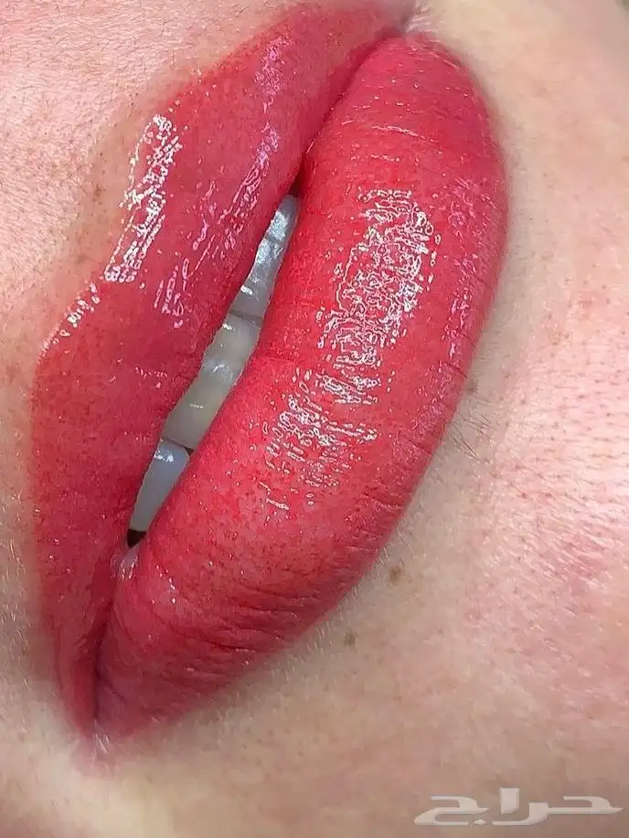 توريد الشفايف بتقنية المايكرو ونتائج تنافس العيادات 7