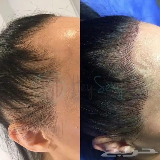 اخصائيه اكستنشن حواجب و مايكرو هير لاخفاء فراغات الشعر 0