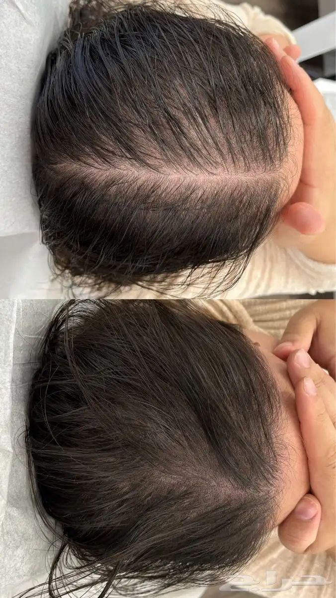 اخصائيه اكستنشن حواجب و مايكرو هير لاخفاء فراغات الشعر 1